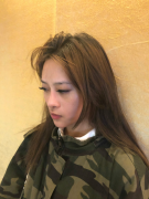 成都艺星医疗美容医院黄文--鼻综合分享