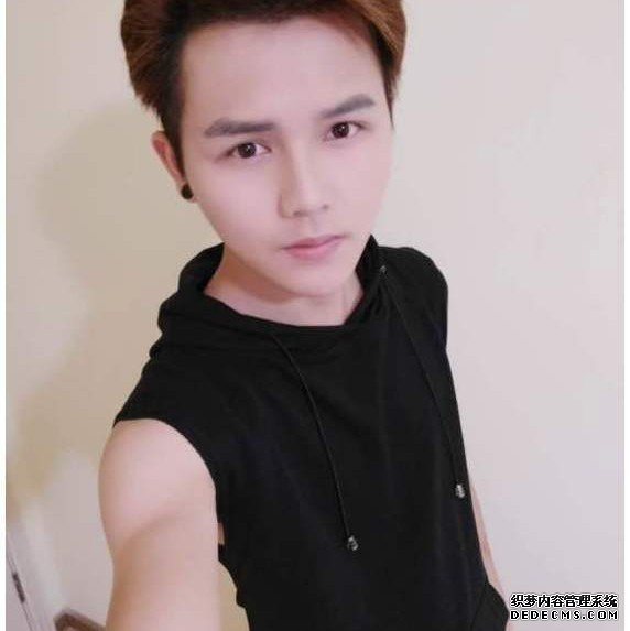 深圳美颜医疗程世昌种植发际线案例拒做