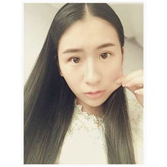  双眼皮+丰下巴前后对比照