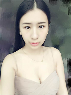  双眼皮+丰下巴前后对比照