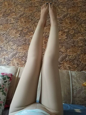 <b>上海茸城医院王海龙吸脂瘦大腿案例分享</b>